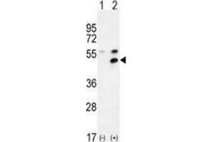 Western Blotting (WB) image for anti-Membrane Protein, Palmitoylated 1, 55kDa (MPP1) (AA 304-331), (Middle Region) antibody (ABIN953491)