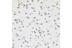 Immunohistochemistry of paraffin-embedded mouse brain using SAFB2 antibody (ABIN5972429) at dilution of 1/100 (40x lens). (SAFB2 抗体)