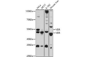 Western blot analysis of extracts of various cell lines, using VDR antibody (ABIN3023180, ABIN3023181, ABIN3023182 and ABIN6219426) at 1:1000 dilution. (Vitamin D Receptor 抗体  (AA 1-300))