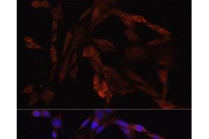 Immunofluorescence analysis of NIH/3T3 cells using OXA1L Polyclonal Antibody at dilution of 1:100. (OXA1L 抗体)