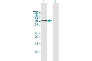 Western Blot analysis of TTC8 expression in transfected 293T cell line by TTC8 MaxPab polyclonal antibody. (TTC8 抗体  (AA 1-505))