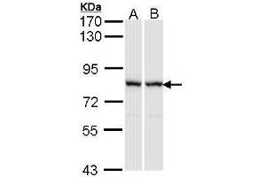 WB Image Sample (30 ug of whole cell lysate) A: A431 , B: Raji 7. (RACGAP1 抗体  (N-Term))