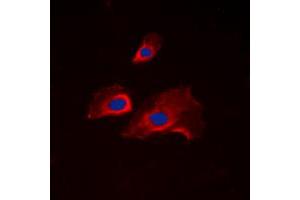 Immunofluorescent analysis of RPS6 (pS235) staining in NIH3T3 cells. (RPS6 抗体  (C-Term, pSer235))