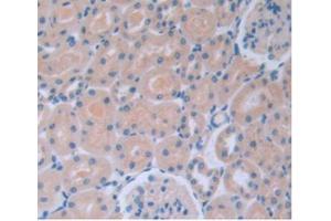 IHC-P analysis of Rat Kidney Tissue, with DAB staining. (IL-6 抗体  (AA 21-211))