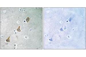 Immunohistochemistry analysis of paraffin-embedded human brain tissue, using PECAM-1 (Ab-713) Antibody. (CD31 抗体  (AA 686-735))