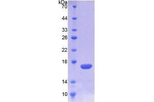 SDS-PAGE analysis of Mouse TREM1 Protein. (TREM1 蛋白)