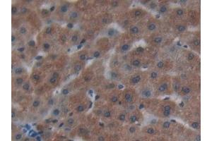 Detection of Cys-C in Human Liver Tissue using Polyclonal Antibody to Cystatin C (Cys-C) (CST3 抗体  (AA 27-146))
