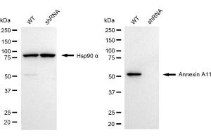 Western blotting analysis using annexin A11 antibody (ABIN7797616). (Annexin A11 抗体)