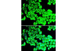 Immunofluorescence analysis of U2OS cells using G3BP1 antibody.