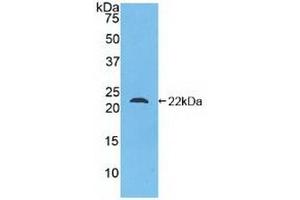 Detection of Recombinant Glucagon, Human using Polyclonal Antibody to Glucagon (GCG) (Glucagon 抗体  (AA 23-180))