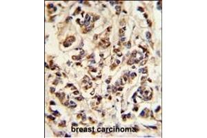 Immunohistochemistry (Paraffin-embedded Sections) (IHC (p)) image for anti-ATPase, H+ Transporting, Lysosomal 70kDa, V1 Subunit A (ATP6V1A) (AA 441-468) antibody (ABIN653735)