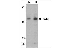 Western blot analysis of PARL in 3T3 cell lysate with this product at (A) 1 and (B) 2 μg/ml. (PARL 抗体  (N-Term))