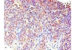 Immunohistochemistry of paraffin-embedded human tonsil tissue using ABIN7159621 at dilution of 1:100 (MECP2 抗体  (AA 1-280))