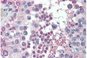 Human Testis (formalin-fixed, paraffin-embedded) stained with MED4 antibody ABIN462248 followed by biotinylated goat anti-rabbit IgG secondary antibody ABIN481713, alkaline phosphatase-streptavidin and chromogen. (MED4 抗体  (AA 146-195))
