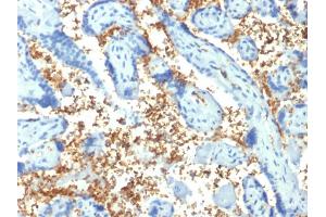 Formalin-fixed, paraffin-embedded human Placenta stained with Spectrin alpha 1 (SPTA1) Mouse Monoclonal Antibody (SPTA1/1810). (SPTA1 抗体  (AA 356-475))