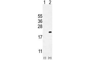 Western blot analysis of CDKN2C antibody and 293 cell lysate either nontransfected (Lane 1) or transiently transfected (2) with the CDKN2C gene. (CDKN2C 抗体  (AA 113-139))