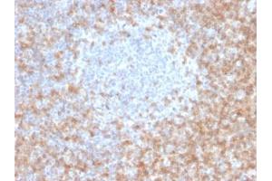 ABIN6383881 to CD5 was successfully used to stain T cells in human tonsil sections. (CD5 抗体  (Extracellular Domain))