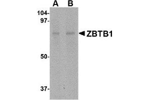 Western Blotting (WB) image for anti-Zinc Finger and BTB Domain Containing 1 (ZBTB1) (Middle Region) antibody (ABIN1031169) (ZBTB1 抗体  (Middle Region))
