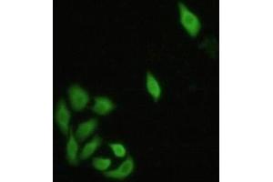 Detection of IRF3 in Hela cells using Polyclonal Antibody to Interferon Regulatory Factor 3 (IRF3) (IRF3 抗体  (AA 1-360))