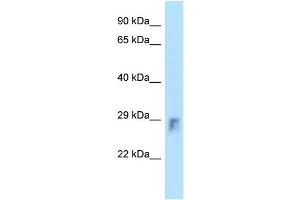 WB Suggested Anti-Rhou Antibody Titration: 1. (RHOU 抗体  (N-Term))