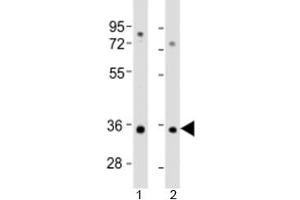 Western blot testing of human 1) A549 and 2) HT-1080 cell lysate with RSPO3 antibody at 1:2000. (R-Spondin 3 抗体  (AA 214-248))