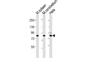 All lanes : Anti-Suz12 Antibody (Center) at 1:2000 dilution Lane 1: mouse spleen lysates Lane 2: mouse cerebellum lysates Lane 3: Hela whole cell lysates Lysates/proteins at 20 μg per lane. (SUZ12 抗体  (AA 381-395))