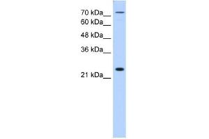 CLDN2 antibody (20R-1258) used at 0. (Claudin 2 抗体  (N-Term))