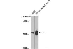 Western blot analysis of extracts of various cell lines using MYL2 Polyclonal Antibody at dilution of 1:3000. (MYL2 抗体)