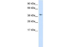 WB Suggested Anti-MSL3L1 Antibody Titration:  0.
