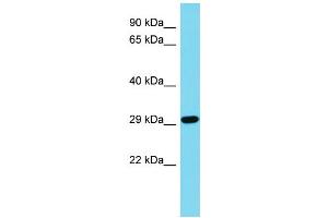 Host: Rabbit Target Name: CDRT15L2 Sample Type: Jurkat Whole Cell lysates Antibody Dilution: 1. (CDRT15L2 抗体  (N-Term))