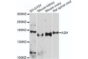 Western blot analysis of extracts of various cell lines, using A2M antibody. (alpha 2 Macroglobulin 抗体  (AA 1155-1474))