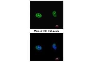 ICC/IF Image Immunofluorescence analysis of paraformaldehyde-fixed HeLa, using S6K2, antibody at 1:100 dilution. (RPS6KB2 抗体  (Center))