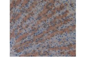 Detection of ARG in Rat Stomach Tissue using Monoclonal Antibody to Arginase (ARG) (ARG 抗体  (AA 1-323))