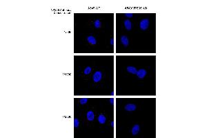 Immunocytochemistry/Immunofluorescence analysis using Mouse Anti-VPS35 Monoclonal Antibody, Clone 8A3 (ABIN6932957). (VPS35 抗体  (Atto 390))