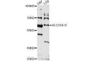 Western blot analysis of extracts of various cell lines, using SLC22A15 antibody (ABIN6293843) at 1:3000 dilution. (SLC22A15 抗体)