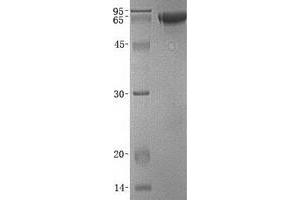 Validation with Western Blot (FLRT1 Protein (His tag))