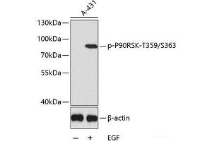 Western Blotting (WB) image for anti-Ribosomal Protein S6 Kinase, 90kDa, Polypeptide 3 (RPS6KA3) (pSer363), (pThr359) antibody (ABIN7265252)