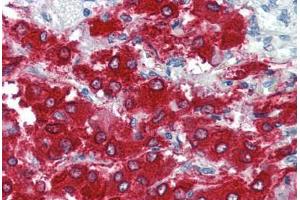 Human Adrenal (formalin-fixed, paraffin-embedded) stained with TH antibody ABIN337188 at 5 ug/ml followed by biotinylated goat anti-rabbit IgG secondary antibody ABIN481713, alkaline phosphatase-streptavidin and chromogen. (Tyrosine Hydroxylase 抗体  (pSer40))