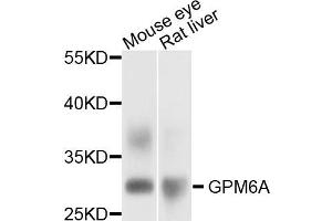 Western blot analysis of extract of mouse eye and rat liver cells, using GPM6A antibody. (GPM6A 抗体)