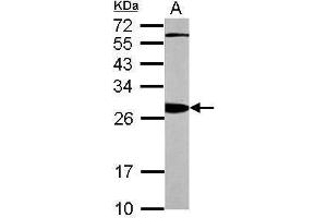 Western Blotting (WB) image for anti-14-3-3 alpha + beta (YWHAB) (Center) antibody (ABIN2856888)