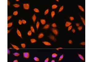 Immunofluorescence analysis of L929 cells using PNPO Polyclonal Antibody at dilution of 1:100. (PNPO 抗体)