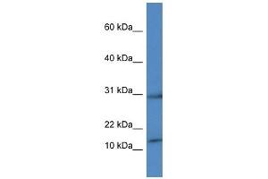 anti-Histone H2A Type 1-H (HIST1H2AH) (C-Term) antibody