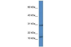 Western Blot showing HIST1H2AH antibody used at a concentration of 1 ug/ml against THP-1 Cell Lysate (HIST1H2AH 抗体  (C-Term))
