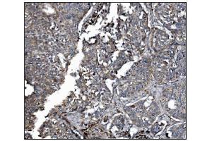 IHC analysis of LRP1B using anti-LRP1B antibody (ABIN7601521). (LRP1B 抗体  (AA 3704-4547))