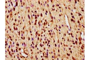 Immunohistochemistry (IHC) image for anti-SMAD, Mothers Against DPP Homolog 1 (SMAD1) (AA 202-335) antibody (ABIN7160224)