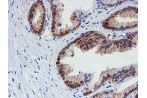 Image no. 1 for anti-Mannose Phosphate Isomerase (MPI) antibody (ABIN1499545) (MPI 抗体)