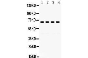 Western Blotting (WB) image for anti-G Protein-Coupled Receptor Kinase 6 (GRK6) (AA 382-417), (C-Term) antibody (ABIN3042435) (GRK6 抗体  (C-Term))