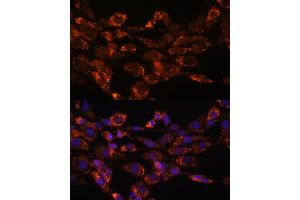 Immunofluorescence analysis of NIH/3T3 cells using Monoamine Oxidase A (Monoamine Oxidase A (MAOA)) antibody (ABIN3021915, ABIN3021916, ABIN3021917 and ABIN6217576) at dilution of 1:100. (Monoamine Oxidase A 抗体  (AA 1-260))