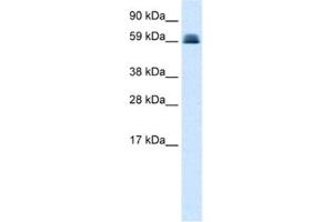 Western Blotting (WB) image for anti-Zinc Finger and BTB Domain Containing 45 (ZBTB45) antibody (ABIN2460150) (ZBTB45 抗体)