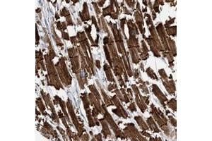 Immunohistochemical staining of human heart muscle with FAM26E polyclonal antibody  shows strong cytoplasmic and membranous positivity in myocytes at 1:500-1:1000 dilution. (FAM26E 抗体)